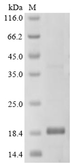 Recombinant Shigella flexneri Aquaporin Z (aqpZ), partial (CSB-EP524789SZB1e3)