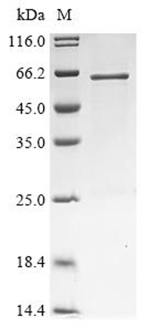 Recombinant Human Protein GOLM2 (GOLM2), partial (CSB-EP764724HU)