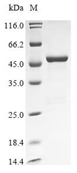 Recombinant Human Aspartate aminotransferase, mitochondrial (GOT2) (CSB-EP009681HU)