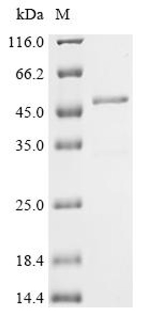 Recombinant Bovine Troponin T, slow skeletal muscle (TNNT1) (CSB-EP843115BO)
