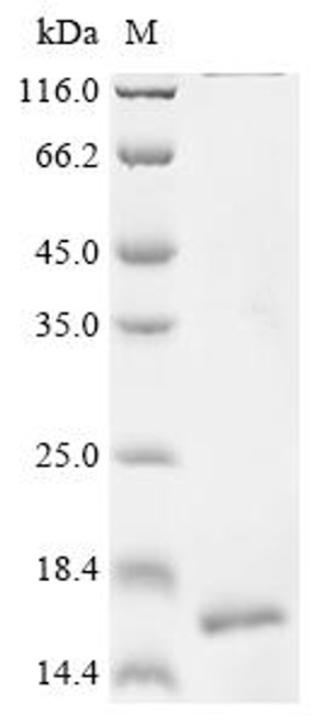Recombinant Human CD9 antigen (CD9), partial (CSB-EP004969HU1)
