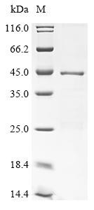 Recombinant Hepatitis B virus genotype D subtype ayw Protein P (P), partial (CSB-EP355966HEM)