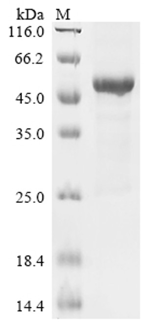 Recombinant Human Meiotic recombination protein SPO11 (SPO11) (CSB-EP897506HU)
