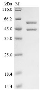 Recombinant Streptococcus pyogenes serotype M1 C5a peptidase (scpA), partial (CSB-EP350120SMT)