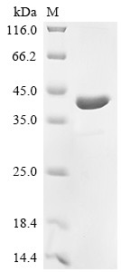 Recombinant Rat Synapsin-2 (Syn2), partial (CSB-EP726914RA2)