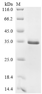 Recombinant Human Tissue factor (F3) (CSB-EP007928HU(F2))