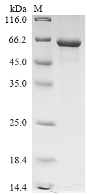 Recombinant Human Cocaine esterase (CES2) (CSB-EP005259HU)