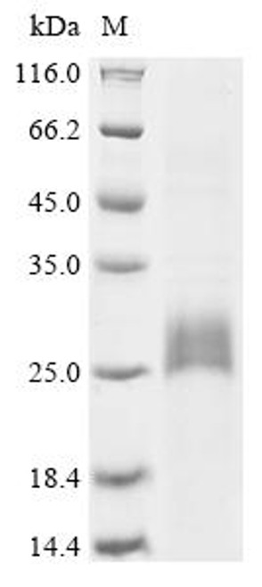 Recombinant Galleria mellonella Serine protease inhibitor dipetalogastin-like (LOC113516003) (CSB-EP4422GET)