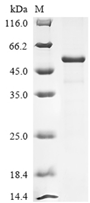 Recombinant Gossypium hirsutum Transcription factor bHLH84-like (LOC107908183) (CSB-EP44483GHB)