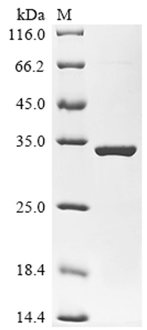 Recombinant Escherichia coli O157:H7 3-deoxy-manno-octulosonate cytidylyltransferase (kdsB) (CSB-EP471458EOE)