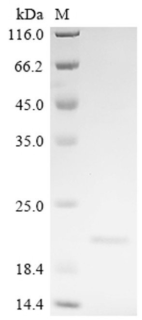 Recombinant Human Proprotein convertase subtilisin/kexin type 6 (PCSK6), partial (CSB-EP017645HU)