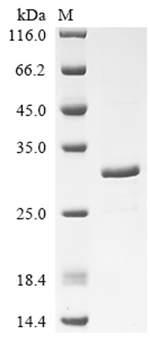 Recombinant Escherichia coli Probable phospholipid-binding lipoprotein mlaA (mlaA) (CSB-EP300563ENV)