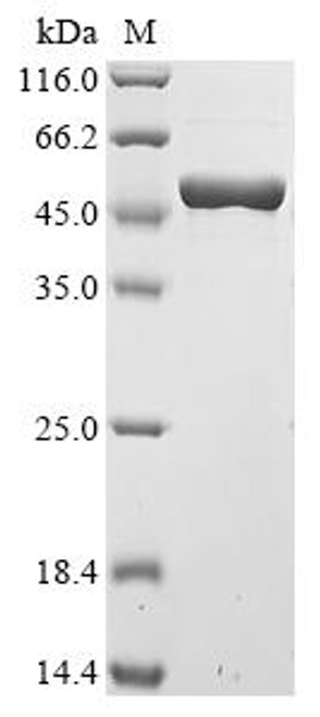 Recombinant Streptococcus pneumoniae serotype 4 Pneumolysin (ply) (CSB-EP314690FMWe1)