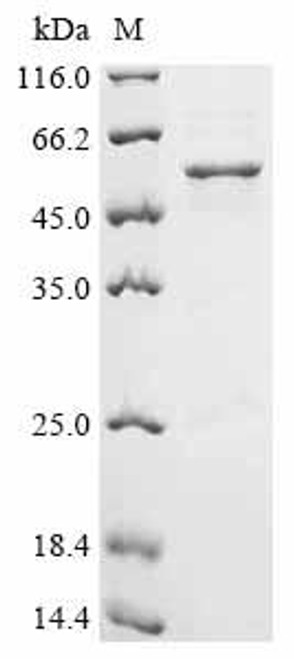 Recombinant Human Lupus La protein (SSB) (CSB-EP022705HUb0)