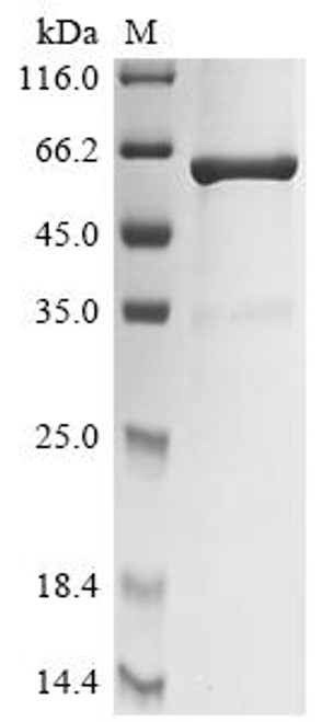 Recombinant Chicken Lysozyme C (LYZ), Biotinylated (CSB-EP013283CH-B)
