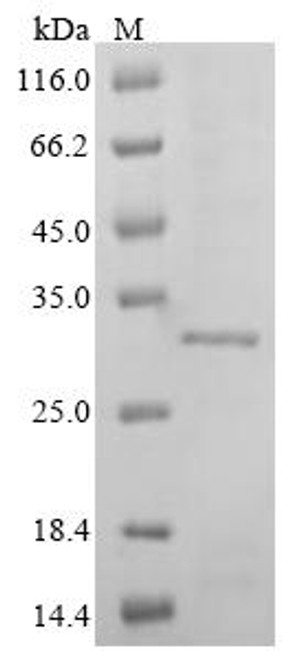 Recombinant Mouse Troponin I, cardiac muscle (Tnni3) (CSB-EP341785MOe1)