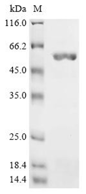 Recombinant Salmonella typhimurium Cell invasion protein sipD (sipD) (CSB-EP710019SXB)