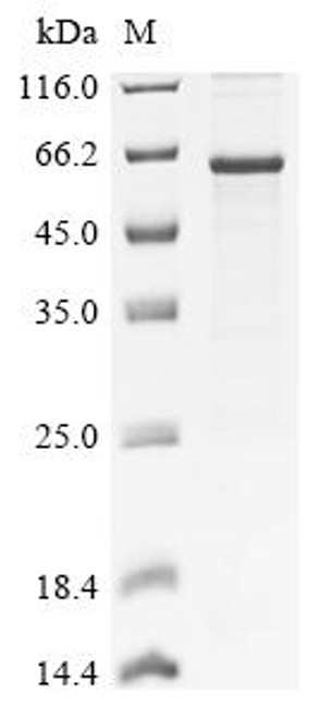 Recombinant Human Squalene monooxygenase (SQLE), partial (CSB-EP613505HU1)