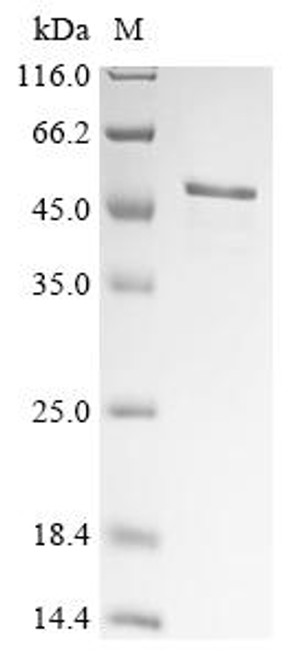 Recombinant Human herpesvirus 1 E3 ubiquitin-protein ligase ICP0 (ICP0), partial (CSB-EP362415HWY)