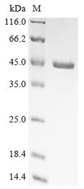 Recombinant Pseudomonas aeruginosa Type IV pilus biogenesis factor PilY1 (pilY1), partial (CSB-EP4766GTO)