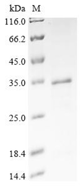 Recombinant Human A-kinase anchor protein 8 (AKAP8), partial (CSB-EP001530HU)