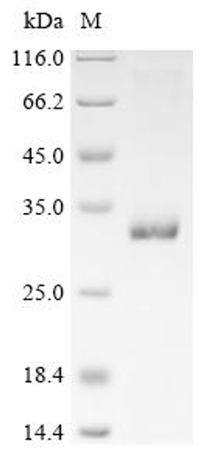 Recombinant Prunus persica Thaumatin-like protein 2 (CSB-EP306065EZK)