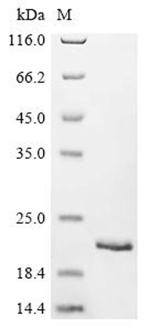 Recombinant Streptococcus pneumoniae Immunoglobulin A1 protease (iga), partial (CSB-EP687514FMW)