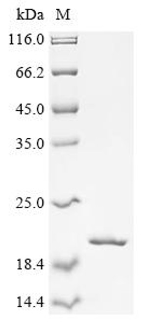 Recombinant Mycobacteroides abscessus ESAT-6-like protein (esxT) (CSB-EP4812GTR)