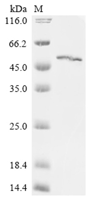 Recombinant Drosophila mauritiana Mariner Mos1 transposase (marinerT) (CSB-EP745313DLT)