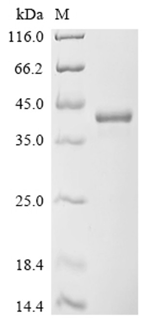 Recombinant Human Transcription factor SOX-2 (SOX2) (CSB-EP022426HUa0)