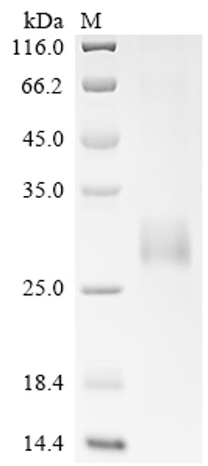 Recombinant Pig Tumor necrosis factor receptor superfamily member 5 (CD40), partial (CSB-EP851448PI)