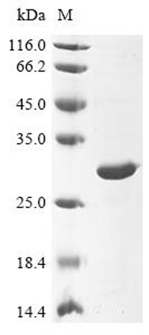 Recombinant Human cytomegalovirus Major capsid protein (MCP), partial (CSB-EP322308HWV)