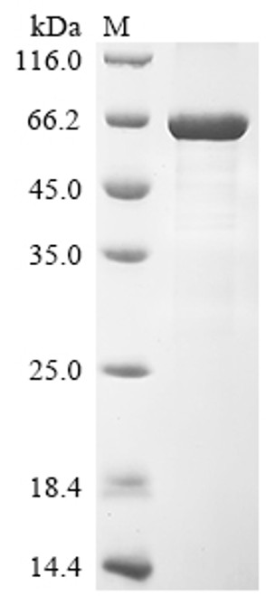 Recombinant Human CCR4-NOT transcription complex subunit 6-like (CNOT6L) (CSB-EP846658HU)