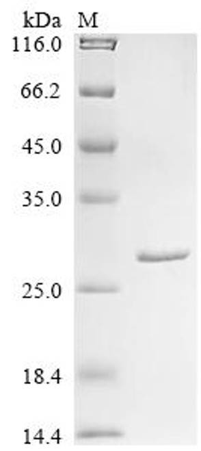 Recombinant Mouse Glutathione S-transferase Mu 1 (Gstm1), partial (CSB-YP009979MO)
