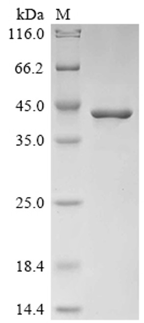 Recombinant Mouse Glutathione S-transferase Mu 1 (Gstm1), partial (CSB-YP009979MOa4)