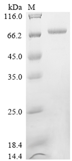 Recombinant Pseudomonas aeruginosa Elastase (lasB) (CSB-YP318584EZX)
