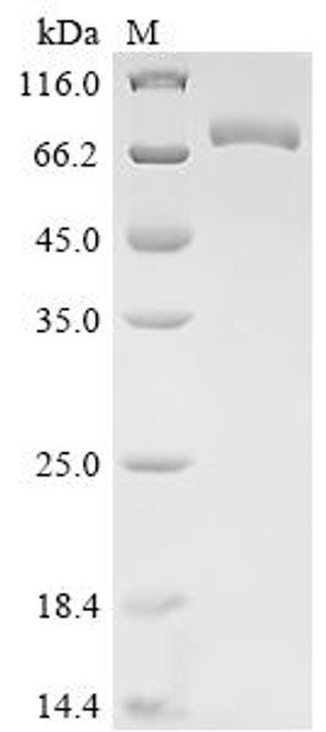 Recombinant Human Prostatic acid phosphatase (ACP3), partial (CSB-MP001181HU1(F2)l3)