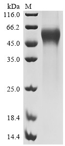 Recombinant Human Membrane cofactor protein (CD46), partial (CSB-MP004939HUc7)