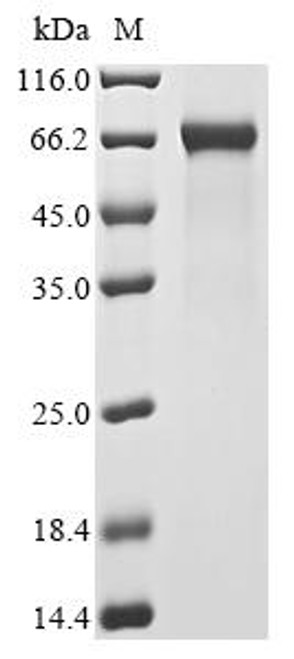 Recombinant Human High mobility group protein B1 (HMGB1) (CSB-MP010553HU)