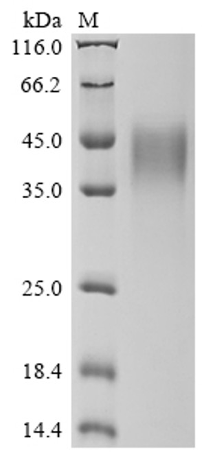 Recombinant Human Interferon gamma receptor 1 (IFNGR1), partial (CSB-MP011051HU1)