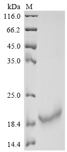 Recombinant Human Interleukin-10 (IL10) (CSB-MP011580HUc7)