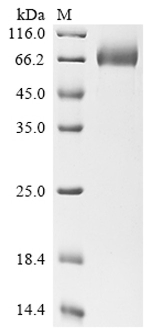 Recombinant Human Mesothelin (MSLN), partial, Biotinylated (CSB-MP015044HU-B)