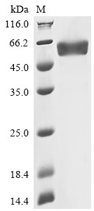 Recombinant Human Oncostatin-M (OSM), partial (CSB-MP017260HU1d9)