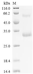 Recombinant Human Gamma-interferon-inducible lysosomal thiol reductase (IFI30), partial (CSB-MP011012HU)