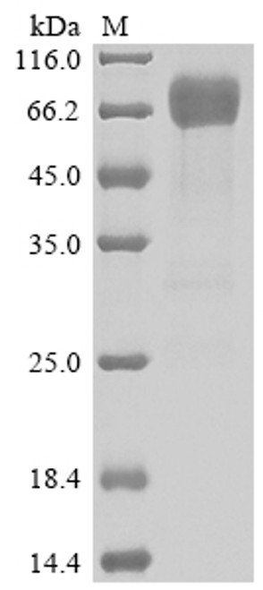 Recombinant Human Interleukin-4 receptor subunit alpha (IL4R), partial (CSB-MP011661HU1)