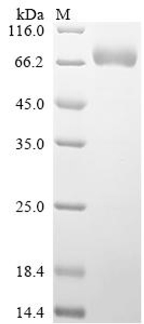 Recombinant Human Sphingomyelin phosphodiesterase (SMPD1) (CSB-MP021845HU)