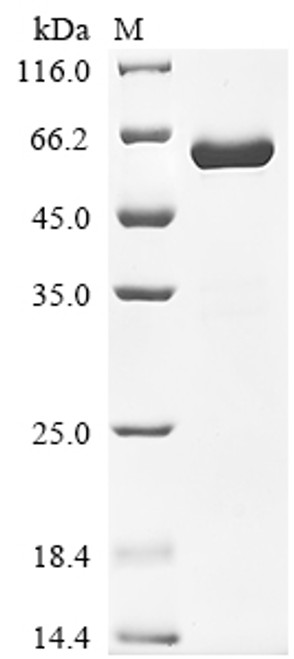 Recombinant Human Insulin-like growth factor-binding protein 7 (IGFBP7) (Active) (CSB-MP620956HUd9)