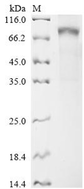 Recombinant Human Butyrophilin-like protein 2 (BTNL2), partial (CSB-MP883443HU)