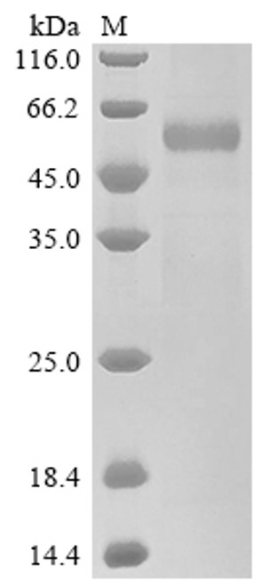 Recombinant Human Placenta growth factor (PGF) (Active) (CSB-MP017854HU)