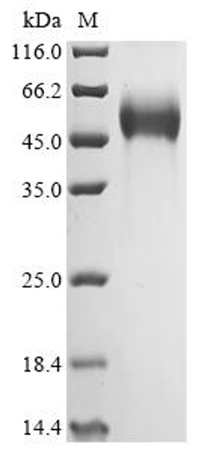 Recombinant Human Tyrosine-protein phosphatase non-receptor type substrate 1 (SIRPA), partial, Biotinylated (CSB-MP021334HU-B)